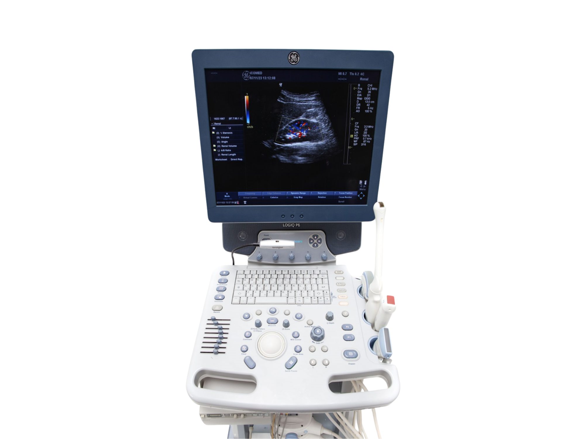 Ultrassom GE Logiq P6, Ultrassom