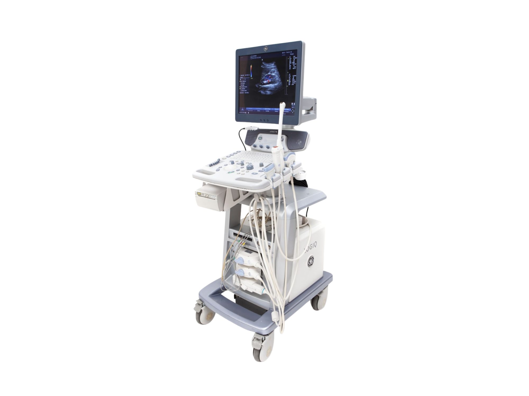 Ultrassom GE Logiq P6, Ultrassom