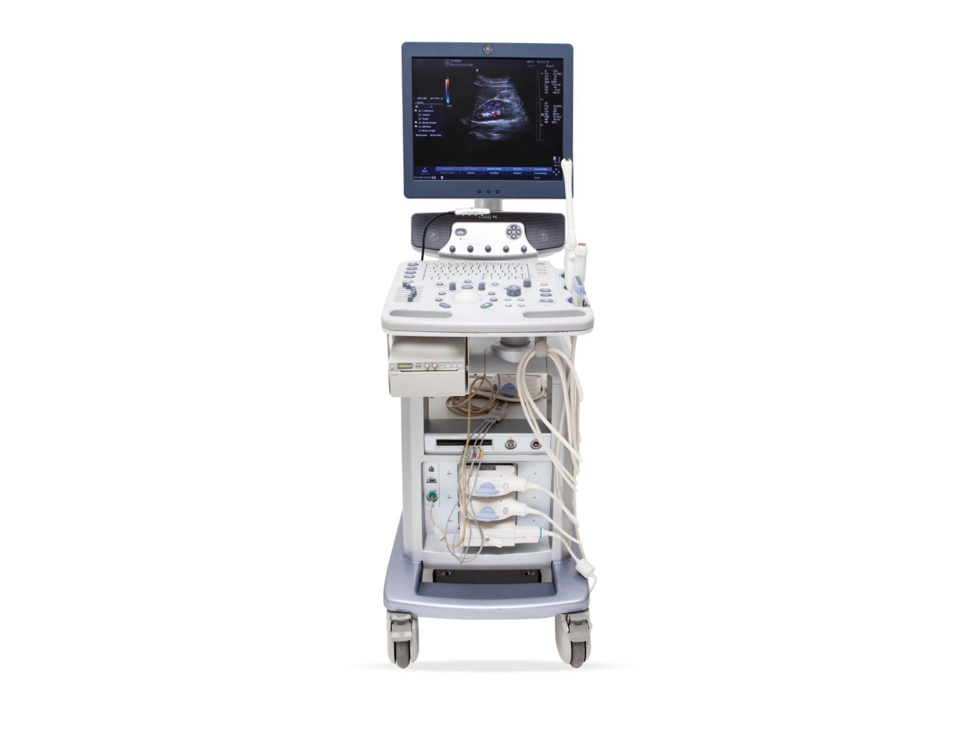 Ultrassom GE Logiq P6, Ultrassom