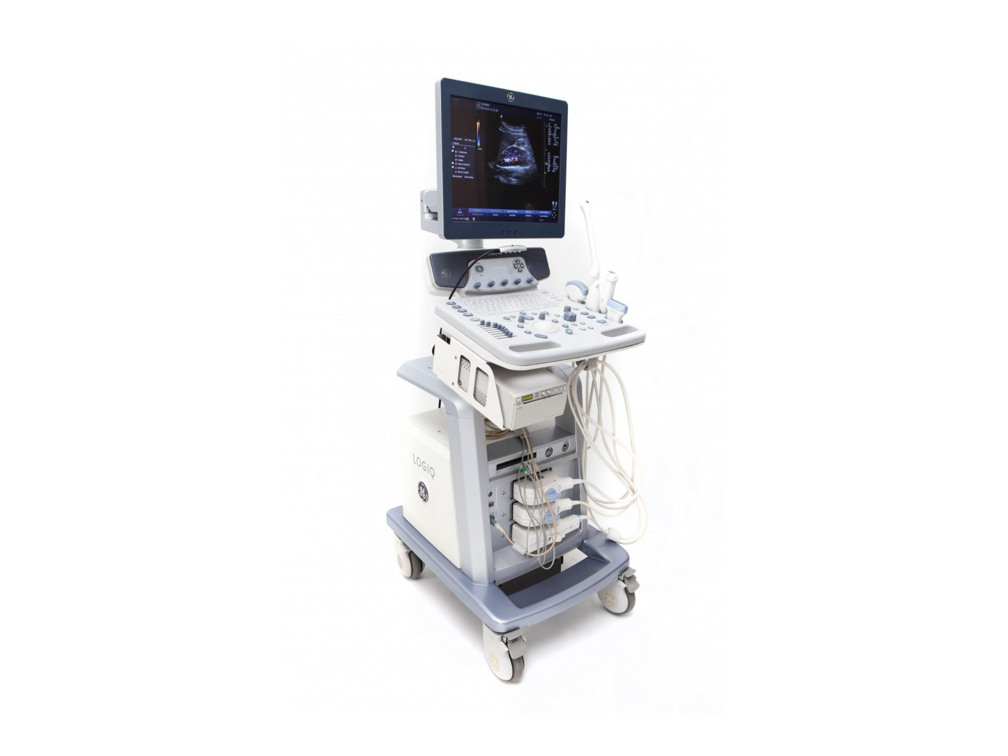 Ultrassom GE Logiq P6, Ultrassom