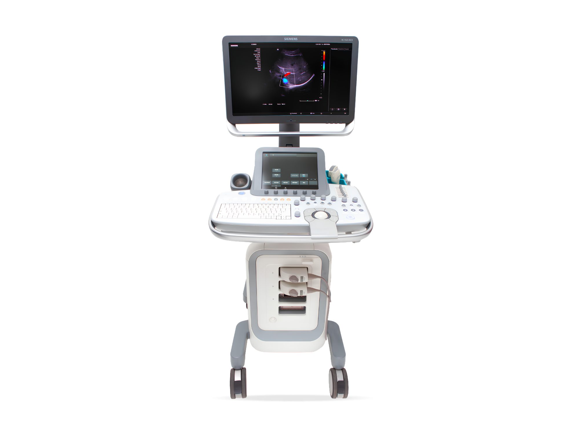 Ultrassom Siemens NX3, Ultrassom