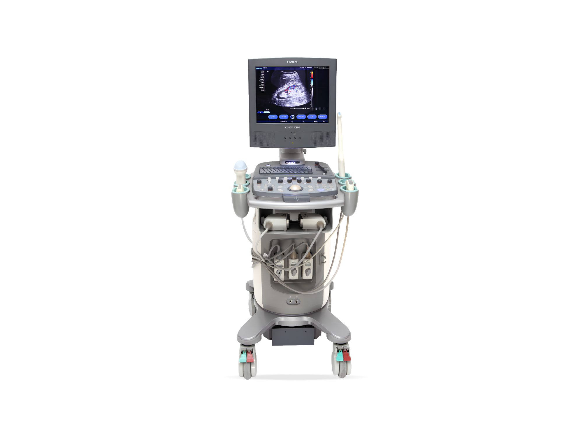 Ultrassom Siemens X300, Ultrassom
