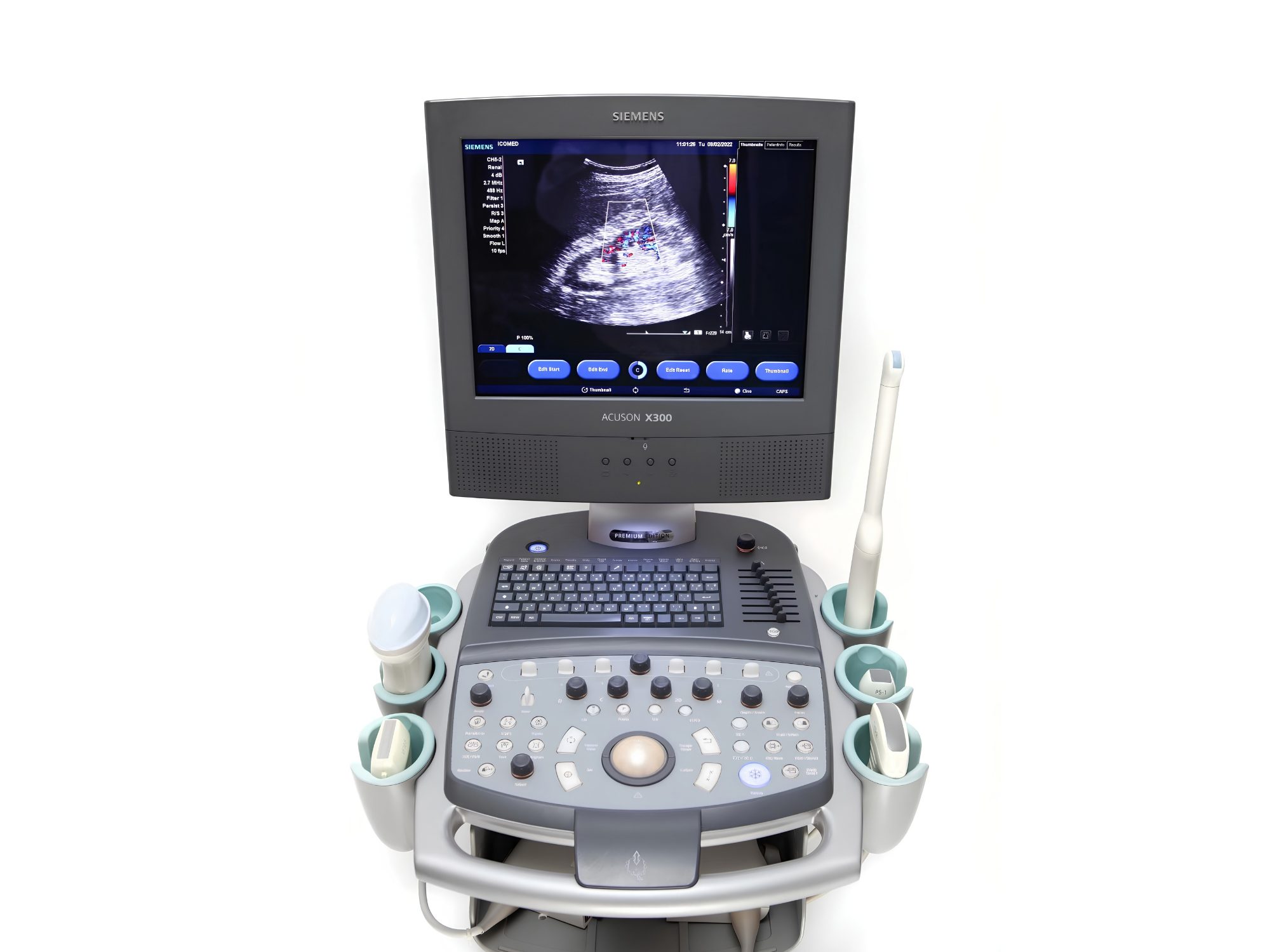 Ultrassom Siemens X300, Ultrassom