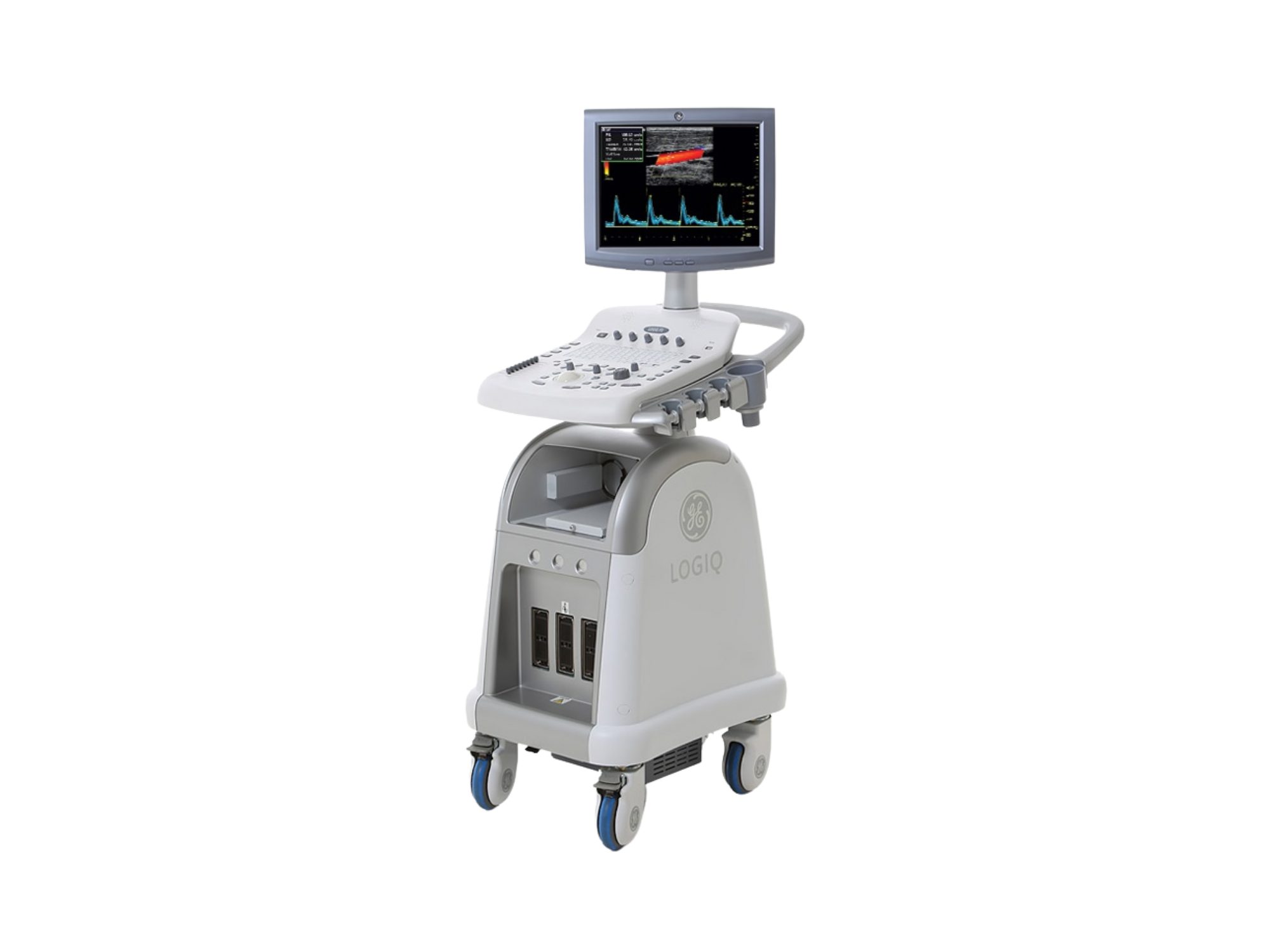 Ultrassom GE Logiq P3, Ultrassom