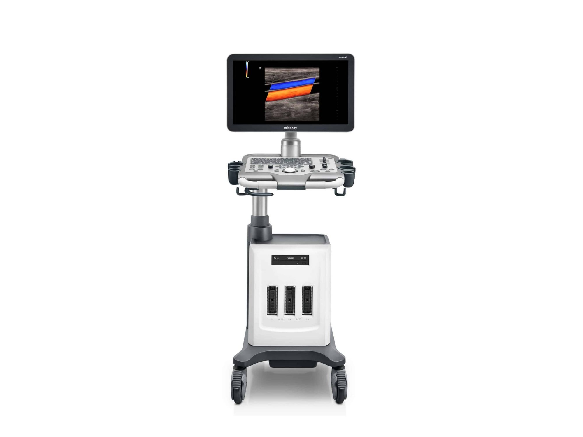 Ultrassom Mindray DC-30, Ultrassom