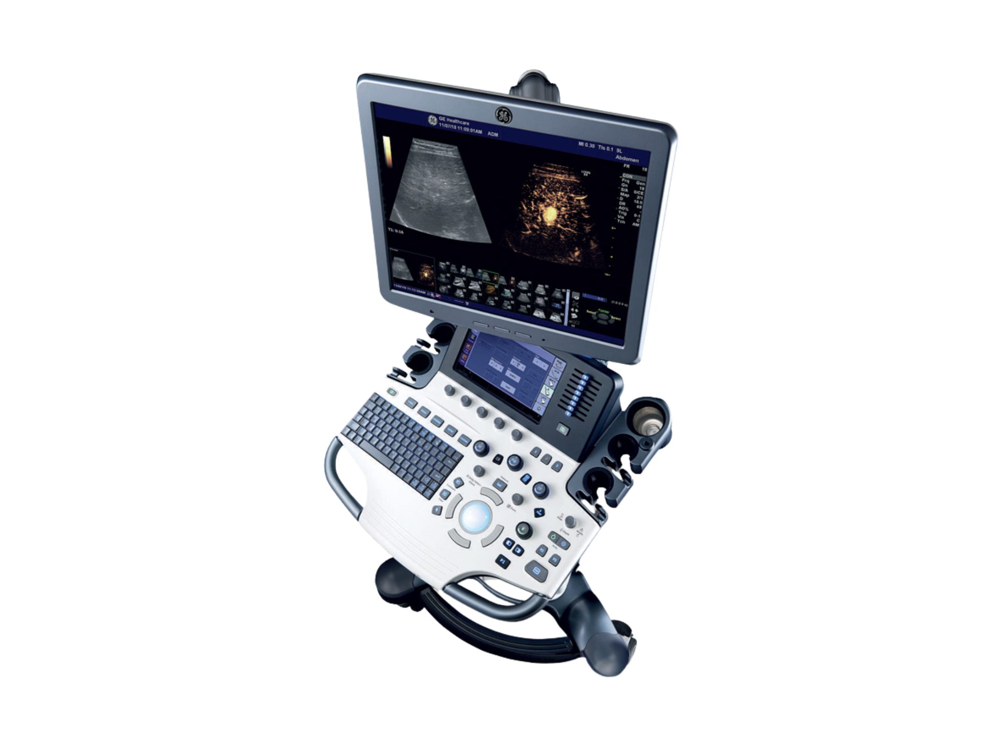 Ultrassom GE Logiq S8, Ultrassom