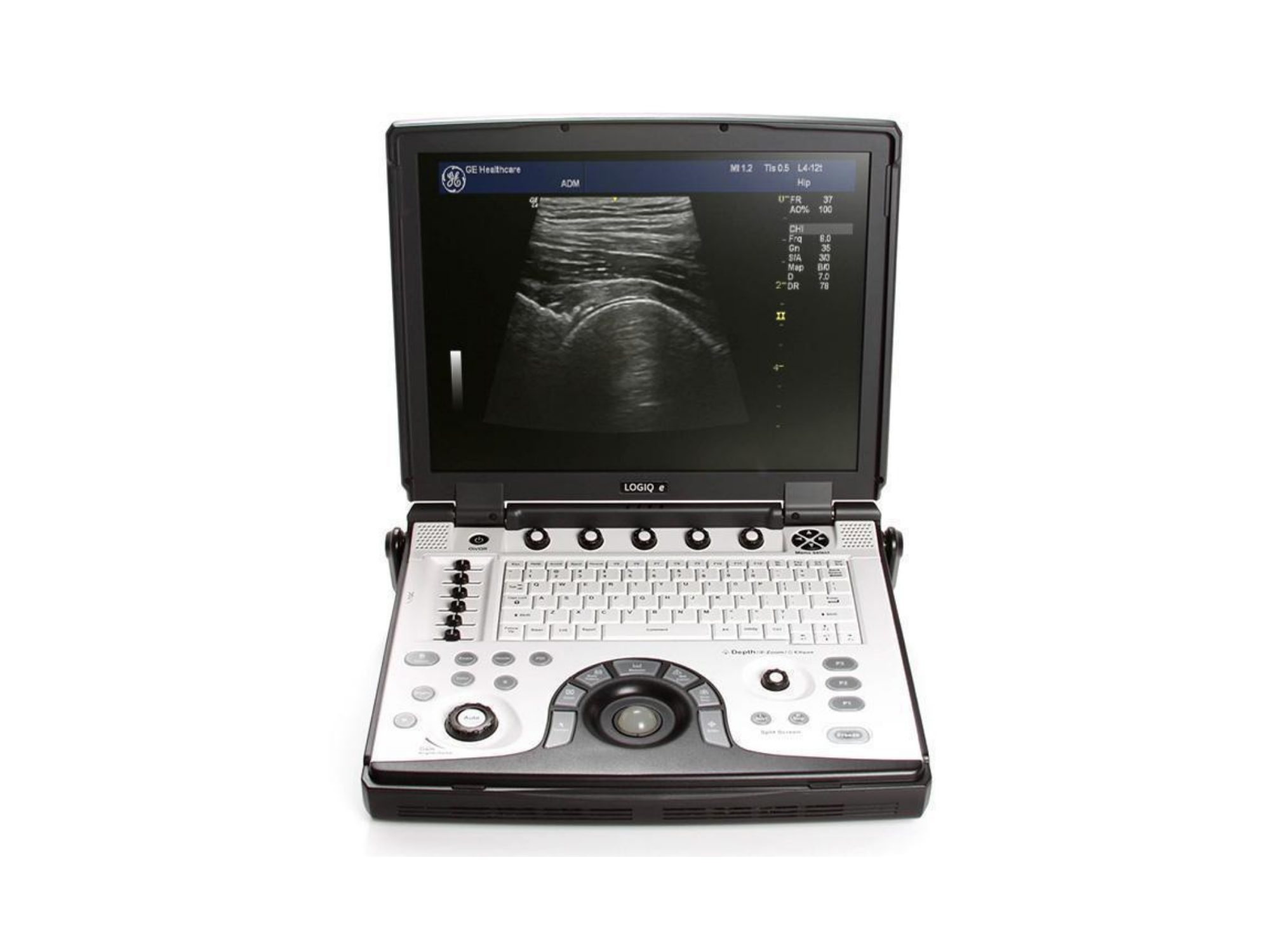 Ultrassom GE Logiq E (Portátil), Ultrassom