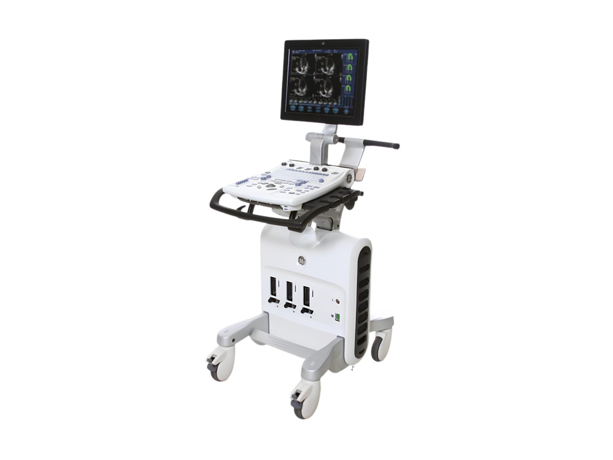 Ultrassom GE Vivid S5, Ultrassom