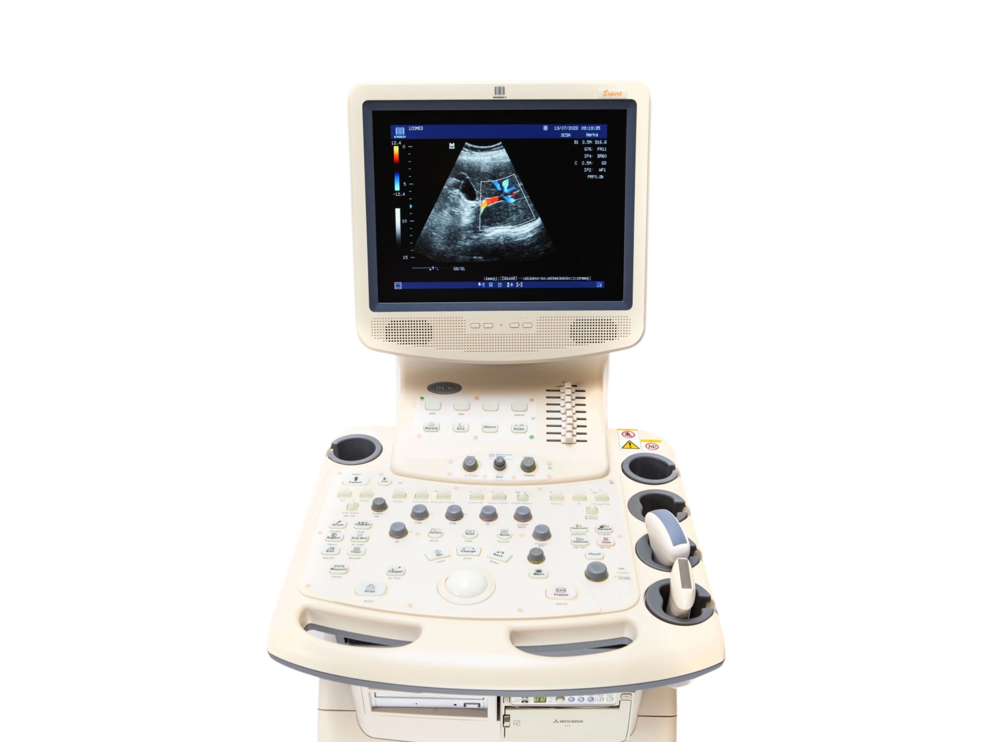 Ultrassom Mindray DC-6, Ultrassom
