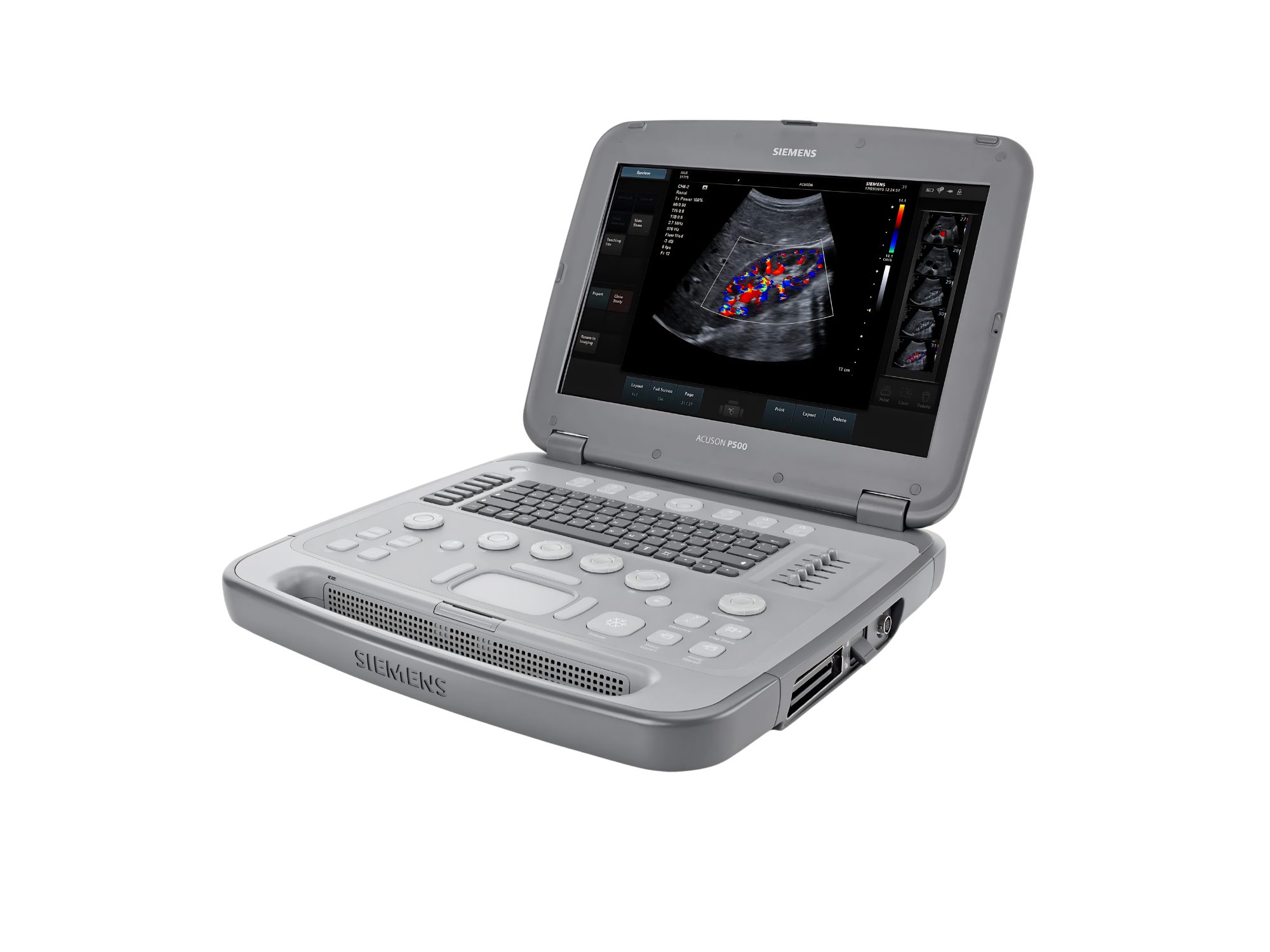 Ultrassom Siemens P500 (Portátil), Ultrassom