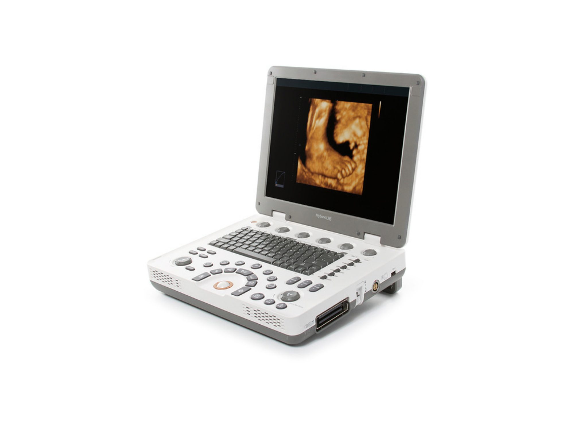Ultrassom Samsung Mysono U6 (Portátil), Ultrassom